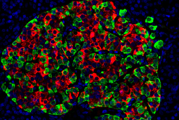 Pancreatic Tissue Therapeutic